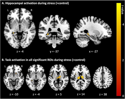 Figure 6. Overview of neural activation during acute psychosocial stress (> control).Note. Displayed are t-values of neural activation (pFWE < .05) during stress (> control) trials of the Montreal Imaging Stress Task. Results are presented (A) centred at the left hippocampus region of interest (MNI coordinates: x = −27, y = −37, z = −4) and (B) as axial slices with corresponding z-coordinates. L = left; R = right.