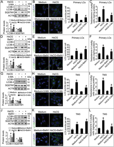 Figure 2. 3-methyladenine and bafilomycin A1 regulate HsCG-induced autophagy in Leydig cells (LCs). Primary LCs were pre-treated with 3-methyladenine (3-MA, 5.0 mM) for 1 h followed by exposure to HsCG for 6 h. (A) The cell extracts were subjected to western blotting and quantitative analysis. (B) Immunofluorescence staining of LC3B and quantitative analyses of LC3 puncta per cell were performed. (C) Testosterone levels were measured by radioimmunoassay. Primary LCs were pre-treated with bafilomycin A1 (BafA1, 10 nM) for 1 h followed by exposure to HsCG for 6 h. (D) The cell extracts were subjected to western blotting and quantitative analysis. (E) Immunofluorescence staining of LC3B and quantitative analyses of LC3 puncta per cell were performed. (F) Testosterone levels were measured by radioimmunoassay. TM3 cells were pre-treated with 3-MA for 1 h followed by exposure to HsCG for 6 h. (G) The cell extracts were subjected to western blotting and quantitative analysis. (H) Immunofluorescence staining of LC3B and quantitative analyses of LC3 puncta per cell were performed. (I) Testosterone levels were measured by radioimmunoassay. TM3 cells were pre-treated with BafA1 for 1 h followed by exposure to HsCG for 6 h. (J) The cell extracts were subjected to western blotting and quantitative analysis. (K) Immunofluorescence staining of LC3B and quantitative analyses of LC3 puncta per cell were performed. (L) Testosterone levels were measured by radioimmunoassay. Data are presented as means ± SEM (n = 3). *P < 0.05 vs. the control cells; #P < 0.05 vs. the HsCG-treated cells