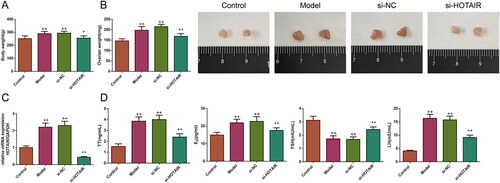 Figure 1. HOTAIR downregulation regulated the weights of the body and ovary as well as the levels of serum hormones in PCOS rats. (A) The changes in body weight in rats; (B) Photographs of ovaries and the changes of ovarian weight in rats; (C) The expression of HOTAIR mRNA in the ovarian tissues among the rats. (D) The levels of serum hormones in rats. Unless otherwise specified, all results were presented as mean ± SD. +p < .05, and ++p < .01 vs.Control; *p < .05, and **p < .01 vs. Model; #p < .05, and ##p < .01 vs. si-HOTAIR in all figures. Note: PCOS, polycystic ovarian syndrome; TT, testosterone; E2, estradiol; LH, luteinizing hormone; FSH, follicle-stimulating hormone.