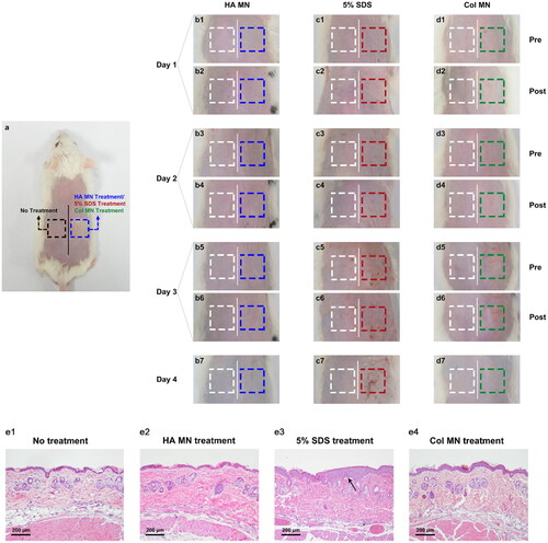 Figure 4. Skin irritation test after different treatments. (a) Diagram of the experimental design showing the skin treatments as annotated. (b–d) Illustration of the dorsal skin of rats after blank MN (b), 5% SDS (c), or Col-loaded MN (d) treatment. (e) Representative H&E staining images of the skin sections of each group. Abbreviations: MN, microneedle; Col, colchicine; SDS, sodium dodecyl sulfate; H&E, hematoxylin and eosin; n = 4.