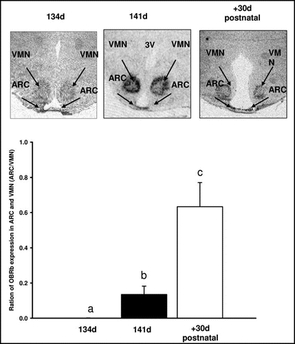 Figure 3 Autroradiographs depicting typical patterns of OBRb expression in the fetal sheep at (A) 134 d gestation (B) 141 d gestation and (C) 30 d of postnatal age. (D) Graph depicting the ratio of expression of OBRb in the arcuate nucleus (ARC) and ventromedial hypothalamus (VMH) at 134 d gestation, 141 d gestation and 30 d of postnatal age. Different letters denote significant differences between age groups p < 0.05. ARC: arcuate nucleus, VMN: ventromedial hypothalamus, 3V: third ventricle.