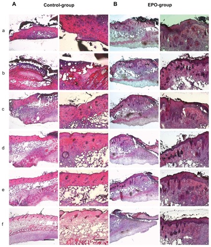 Figure 3 Representative hematoxylin and eosin stainings of scalded skin tissue samples from mice on day 7 after injury and continuous application of rhEPO or vehicle by subcutaneous injection. (A) Control group without EPO (vehicle only), mouse 1 (a–f); (B) EPO group, mouse 2 (a–f) on day 14; (C) control group, mouse 5 (a–f); (D) EPO group, mouse 8 (a–f). Magnification 40× or 100×, scale bar is 500 μm or 200 μm, respectively. In order to obtain a three-dimensional view of the wound area, each 100 μm thickness comparative slides were subjected to qualitative and quantitative evaluation. All evaluations were performed on hematoxylin and eosin routine stainings. The following histological parameters were examined and scored: wound closure in the form of assessment of remaining wound area and re-epithelialization (presence or absence of epithelial covering, degree of epithelial covering relative to number of epithelial cell layers as monolayer or multilayer designed, presence of conical structures). All criteria used for histological scoring of wound healing are summarized in Table 1. In order to render the observations comparable, sections every 100–200 μm in depth were evaluated at low-power (40×) and high-power magnification (100×).Notes: a–f: from a to b; b to c: c to d; d to e; e to f is a 100–200 μm distance of the cryosection.