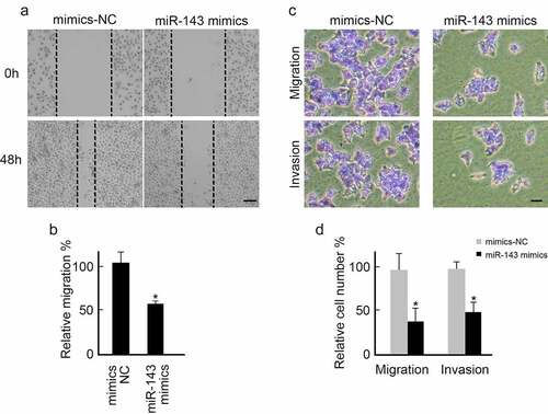 Figure 4. Over-expression of miR-143 inhibits PTC cells metastasis. (a) TPC-1 cells transfected with miR-143 mimics or mimics-NC were subjected to wound healing assay. Representative images were shown. scale bar = 250 μm. (b) Over-expression of miR-143 decreased wound healing speed in TPC-1 cells analyzed from (A). *p < 0.05. (c) TPC-1 cells transfected with miR-143 mimics or mimics-NC were subjected to the trans-well assay with or without Matrigel. Representative images were shown. scale bar = 100 μm (d) Over-expression of miR-143 decreased TPC-1 cells migration and invasion analyzed from (C).