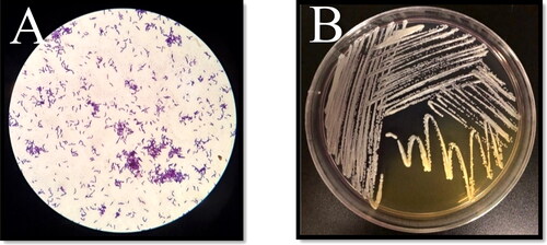 Figure 1. Morphology of P. acnes. (A) P. acnes under the light microscope magnified 100×, cells occur singly or in pairs and arranged in Chinese letters. (B) Pure culture of P. acnes showing partial changes in the color of the medium due to the production of propionic acid.