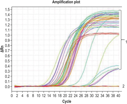 Figure 2. Specificity of qPCR. Curve 1 corresponds to G. anatis and the positive control sample; curve 2 corresponds to other bacteria and the negative control.