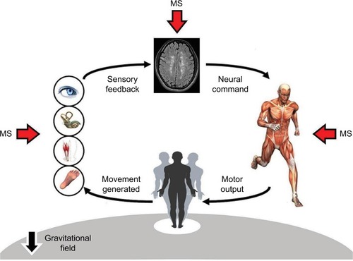 Figure 1 Schematic of postural control and its alterations in MS.
