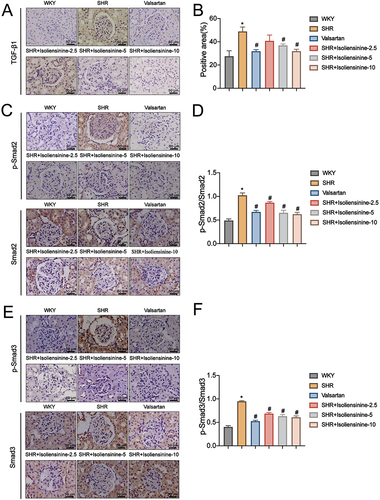 Figure 6 Inhibitory effect of Isoliensinie on TGF-β1/Smad2/3 signaling in-vivo using immunohistochemistry (IHC). (A and B) IHC was used to measure TGF-β1 protein expression in renal tissues and calculate the number of TGF-β1-positive cells. (C–F) IHC was also used to determine the expression of p-Smad2/Smad2 and p-Smad3/Smad3 and the proportion of positive regions in rat renal tissues. Micrographs were taken at 400× magnification with 50 µm scale bar and all results were presented as mean ± SD (n = 6 for each group). Significant differences were noted with *P < 0.05 vs WKY and #P < 0.05 vs SHR groups.