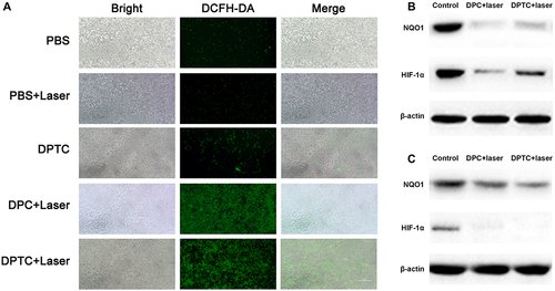 Figure 5 Synergistic mechanisms of DPTC. (A) Fluorescent images of intracellular ROS levels with different treatments of DPTC in B16 cells. The scale bar represents a length of 100 μm. Western blot results of NQO1 and HIDF-1α on (B) B16 cells and (C) SCL-1 cells.