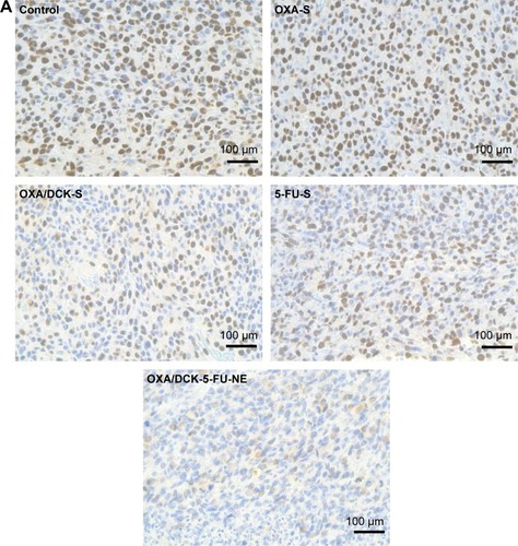 Figure 9 Representative cross-sectional images of isolated tumor tissues stained with PCNA for proliferating cells (brown) (A) and TUNEL for apoptosis (green fluorescence) (B) in the tumor tissues taken 18 days after treatment with various modes.Notes: The treatment modes were once-daily oral administration of 10 mg/kg OXA (OXA-S), OXA/DCK complex as 10 mg/kg of OXA (OXA/DCK-S), 10 mg/kg 5-FU (5-FU-S), or nanoemulsion E (Smix,2 1:1) including OXA/DCK complex as 10 mg/kg of OXA and 10 mg/kg 5-FU (OXA/DCK-5-FU-NE) for 18 days (n=10 for each group). Scale bars represent 100 μm for PCNA staining and 10 μm for TUNEL staining.Abbreviations: PCNA, proliferating cell nuclear antigen; TUNEL, fluorescent terminal deoxynucleotidyl transferase-mediated dUPT nick end labeling; OXA, oxaliplatin; OXA/DCK, ion-pairing complex between oxaliplatin and deoxycholic acid derivative; 5-FU, 5-fluorouracil; Smix,2, a mixture of Cremophor EL (surfactant) and Transcutol HP (co-surfactant).