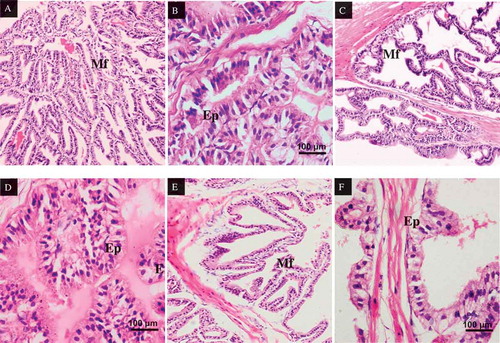 Figure 8. Seminal vesicle cross-sections of rats, stained in H&E. (A) Seminal vesicle of rats in control group, X100. Mucous layer are thin in structure, branching out and folded to form an uneven anastomos branches (Mf). (B) Seminal vesicle of rats in control group, X400. The epithelium of seminal vesicle also consists of closely arranged columnar cells. (C) Seminal vesicle of rats in MSG60 group, X100. The mucosal folding (Mf) decreases compared to the control group. (D) Seminal vesicle of rats in MSG60 group, X400. The cell structure arrangements observed to be irregular and uneven in the epithelium lining. (E) Seminal vesicle of rats in MSG120 group, X100. Decrease in number of mucosal folding (Mf) compared to the control MS 60 groups. (F) Seminal vesicle of rats in MSG120 group, X400. The cell structure arrangements observed to be irregular and uneven in the epithelium (Ep) lining of MSF120 group compared to MSG60 and control groups.