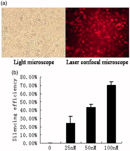 Figure 1. Assessments of transfection efficiency and silencing efficiency of siRNA. (a) Under normoxia, HK-2 cells were transfected with siGLO red transfection indicators for 24 h. HK-2 cells were observed under bright field and confocal microscope in the same field (magnification 200×), respectively. (b) Under normoxia, HK-2 cells were transfected with HIF-1α siRNA at different concentrations (0, 25 nM, 50 nM, and 100 nM). Real-time PCR was used to quantify the mRNA expression of HIF-1α. Silencing efficiency of HIF-1α siRNA at 0 nM was defined as 0%. Silencing efficiency of HIF-1α siRNA = amount of HIF-1α mRNA at some concentration/amount of HIF-1α mRNA at 0 nM (%). Results (means ± SD) are from 3 sets of experiments.
