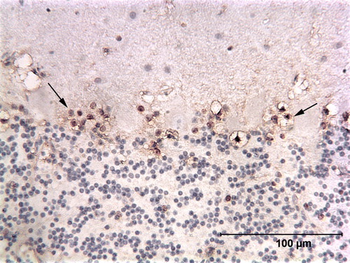 Figure 2.  Immunoperoxidase-stained cerebellum of a cockatiel (Case 0427) showing a band of cells staining for ABV N-protein in the Purkinje cell layer. Many of these positive cells are showing extensive cytoplasmic vacuolation. Note that the Purkinje cells themselves do not appear to contain viral protein. Arrows point to stained cells.