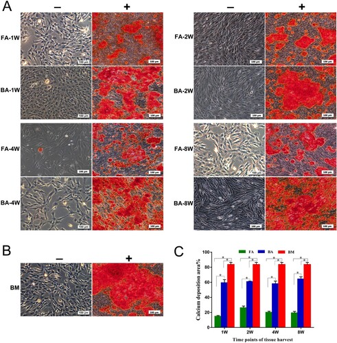 Figure 5. Osteogenic differentiation assay for the detection of calcium deposits using alizarin red (AR) stain. (A) and (B) Mineralized calcium nodules in an osteogenic differentiation medium (+) after culture for 14 days compared with the negative AR staining in the control medium (−) for each group of MSCs. Scale bar: 100 μm. (C) Bar graph representing the percentage of area with positive staining for AR, expressed as mean ± standard deviation. Calcium deposits were measured in three independent samples for each group (n = 3). *P < .05. FA, fibrous ankylosis; BA, bony ankylosis; BM, bone marrow; MSCs, mesenchymal stromal cells.