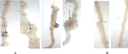 Figure 1 Representative macroscopic appearance of the colorectum with and without tumors; Dimethyl hydrazine treated group (A), Normal Control (B). The black arrows indicate the tumors on the epithelium of colorectum.