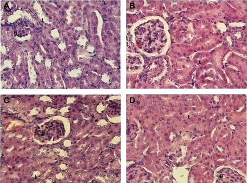 Figure S1 Histopathological studies.Notes: Photomicrographs of kidney samples from AmB-D (A), AmB-L (B), AmB–PGA (C), and healthy control (D) groups. The AmB–PGA-treated group shows intact renal corpuscle with normal glomerular cellularity (g), urinary space, and lining cells of the renal tubules (t). 200×, hematoxylin and eosin stain.Abbreviations: AmB, amphotericin B; PGA, polyglutamic acid; AmB-D, Fungizone®; AmB-L, Ambisome®.