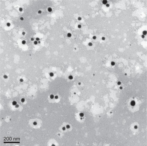 Figure 3 Transmission electron microscopy of a microemulsion (ME3).