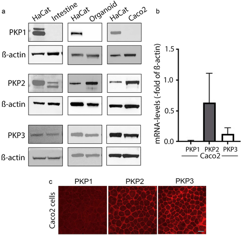 Figure 1. Plakophilin2 and Plakophilin3 are expressed in human intestinal tissue.