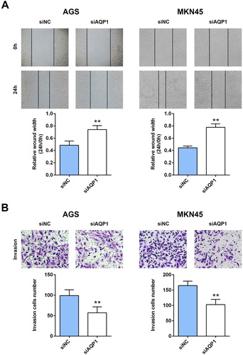 Figure 3. Interference of AQP-1 inhibited gastric cancer migration and invasion. (A) The effect of AQP-1 on cell migration of AGS and MKN45 cells detected by wound healing assay. ** represents siAQP1 vs. siNC, P < .01. (B) The effect of AQP-1 on cell invasion of AGS and MKN45 cells detected by transwell assay. ** represents siAQP1 vs. siNC, P <  .01.