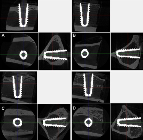 Figure 7 Micro-computed tomographic images 8 weeks after implant installation. (A) Machined surface group, (B) SLA surface group, (C) TiO2 nanotube array surface group, and (D) TiO2 nanotube array surface with rhBMP-2 group.Abbreviations: TiO2, titanium dioxide; rhBMP-2, recombinant human bone morphogenetic protein-2; SLA, sandblasted large-grit and acid-etched.