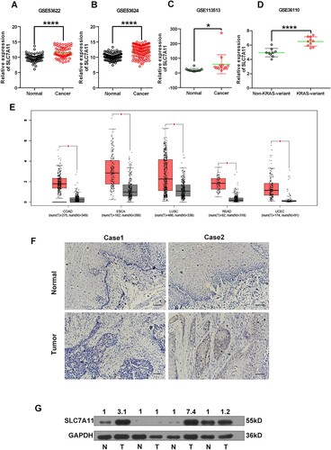 Figure 1. SLC7A11 was overexpressed in ESCC tissues. The mRNA levels of SLC7A11 in GSE53622 and GSE53624 ESCC datasets (A and B), GSE113513 CRC dataset (C), and GSE36110 HNSCC dataset (D). (E) The mRNA levels of SLC7A11 in COAD, ESCA, LUSC, READ, and UCEC were analyzed using the GEPIA database. (F) IHC staining of SLC7A11 in ESCC tissues and adjacent normal tissues. (G) The protein levels of SLC7A11 in paired normal and tumor tissues were analyzed using the Western blotting method. *, p < 0.05; ****, p < 0.0001.