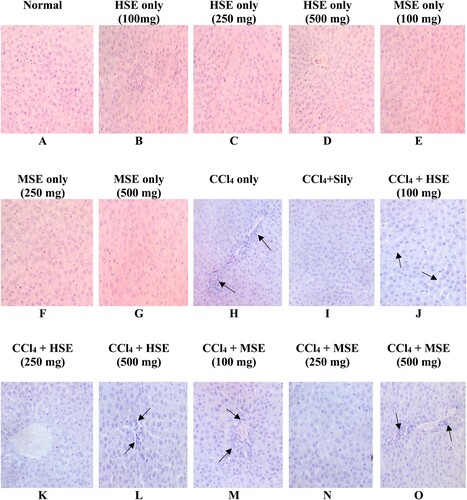 Figure 4. Photomicrographs of liver from male rats administered orally for 7 days Photomicrograph (A) – (G) shows normal hepatocytes with no observable lesion (F0); (H) showed severe destruction of the hepatic architecture with portal fibrous strands. (black arrows, F3); (I) shows no observable hepatic degeneration (F0); (J) shows mild degeneration with sinusoidal dilation (black arrows, F1); (K) recorded no observable lesion (F0); (L) shows mild degeneration with sinusoidal dilation (F1); (M) shows mild necrosis with centrilobular atrophy of hepatocytes (black arrows, F2); (N) shows normal hepatocytes with no observable lesion (F0); (O) shows degeneration of hepatocytes with moderate necrosis (black arrows, F2). (H&E x 400). From Metavir system; level of fibrosis from F0 to F3.