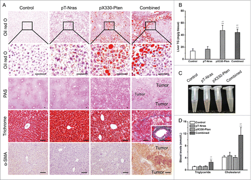 Figure 4. Pten disruption resulted in hepatic deposition of lipid droplets and glycogen. Samples from 5 mice in each group were collected 16 weeks after plasmid injection. (A) Representative images of Oil red O staining, periodic acid-Schiff (PAS) staining, Masson's trichrome staining, and α-smooth muscle actin (α-SMA) immunohistochemistry. Scale bar = 50 μm. (B) Hepatic triglycerides content. (C) Representative images of plasma. (D) Blood levels of triglyceride and cholesterol. Values in (B) and (D) represent average ± SD (n = 5). ** P < 0.01 compared with the control; ## P < 0.01 compared with mice injected with pT-Nras.