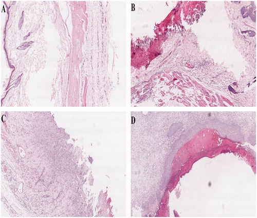 Figure 5. Histological photomicrographs of rats' skin (H&E stain × 40, (A) Normal control group; (B) Model group; (C) GLT–carbopol gel; (D) GLT nanogel).