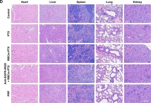 Figure 7 In vivo antitumor activity and safety study.Notes: Mice-bearing MKN45 subcutaneously were used as an animal model. Mice were treated by tail vein injection of PBS, PTX alone, RBCm-PTX, coadministration of anti-EGFR-iRGD and RBCm-PTX, or PRP twice a week for 2 weeks. (A) The tumor growth curves, (B) the net weight of xenografts after harvesting, and (C) the body weight change of the tumor-bearing mice. Data are represented as mean±SEM (n=5). One-way analysis of variance was used for the analysis of tumor volume and body weight. *P<0.05 and **P<0.001. (D) Main organs were dissected for H&E staining on the 15th day after treatment. Main organs, including heart, liver, spleen, lung, and kidney. Inflammatory cells’ infiltration could be seen in some cases, while none significant abnormal damage was observed. Scale bar=100 μm. PRP, PTX-loaded RBCm-derived microvesicles functionalized with anti-EGFR-iRGD.Abbreviations: PTX, paclitaxel; RBC, red blood cell; RBCm, RBC membrane; SEM, standard error of the mean.