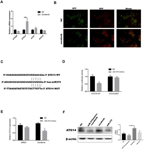 Figure 5 Autophagy-related protein 14 was a direct target of miR-375. (A) Real-time PCR was used to evaluate ATG14 levels in Huh7 cells treated with sorafenib. (B) We constructed a GFP-RFP-LC3 lentivirus that emitted green and red light in response to sorafenib treatment (sorafenib: 5 μM, 12 h). (C, D) The binding sites for miR-375 in the 3ʹ-UTRs of ATG14 were determined, and luciferase reporter assays were performed to confirm the relationships between miR-375 and ATG14. (E) Real-time PCR was used to measure ATG14 mRNA levels in Huh7 cells transfected with miR-375 mimics and treated with or without sorafenib (sorafenib: 5 μM, 12 h). (F) Western blotting was used to measure ATG14 protein levels in Huh7 cells transfected with miR-375 mimics and treated with or without sorafenib (sorafenib: 5 μM, 12 h). Data are expressed as mean ± SD of three independent experiments. The p-values represent comparisons between groups (**P < 0.01, ***P < 0.001).