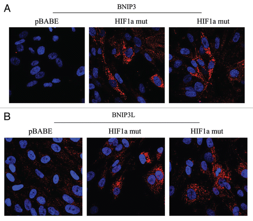 Figure 5 Localization of mitophagy markers (BNIP3 and BNIP3L) in activated HIF1a transfected fibroblasts. BNIP3 and BNIP3L are two distinct genes which are markers of mitophagy, and are thought to be under the transcriptional control of HIF1a activation. Note that both BNIP3 (A) and BNIP3L (B) are upregulated in fibroblasts harboring activated HIF1a, as compared with the vector alone control (pBABE). Both show a morphological pattern that is consistent with mitochondrial and/or autophagosomal localization, as expected.