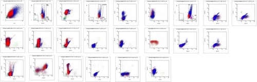 Figure 2 Immunophenotyping by flow cytometry of the blasts at acute myeloid leukemia phase.