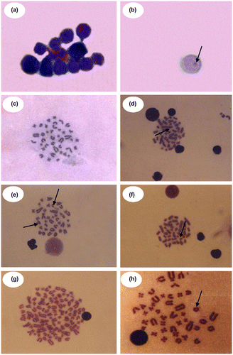 Figure 4 (Color online) Photomicrograph showing polychromatic erythrocytes (a) and micronucleated cell (b) in the bone marrow cells of Rattus norvegicus treated in vivo with different doses of dicholorophene intraperitoneally and metaphase plates of bone marrow cells for different types of chromosomal aberrations with dicholorophene (c–h); (c) Normal metaphase; (d) Dicentric; (e) Acentric fragment and Gap; (f) Break; (g) Polyploidy; (h) Ring (100X oil immersion lens).