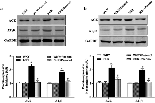 Figure 5. Effect of paeonol on the protein expressions of renal and vascular ACE and AT1R in WKY rats and SHRs. The WKY rats and SHRs were treated with vehicle or paeonol (5 g/kg/day) for 5 weeks. Renal (a) and vascular (b) ACE and AT1R protein expressions were determined by immunoblotting. Data are expressed as the means ± S.E.M (n = 6/group). *P < .05 vs WKY; #P < .05 vs SHR.