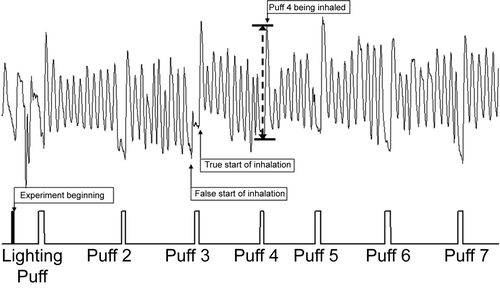 Figure 1.  Respitrace pattern: tidal volume versus time (upper) with event marker (lower).