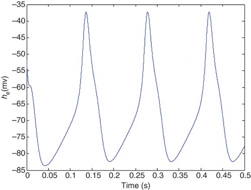 Figure 2. Epileptic state of he.