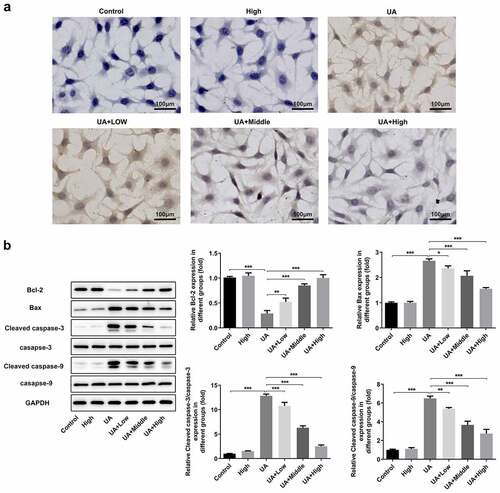 Figure 6. WFA blocks UA-induced apoptosis in NRK-52E cells. (a) Apoptosis of NRK-52E cells induced by UA was evaluated using TUNEL staining. (b) The levels of apoptosis-associated proteins was tested with western blot analysis. Data were presented as the mean ± standard deviation of three independent experiments. *P < 0.05, **P < 0.01 and ***P < 0.001. Withaferin A; UA, uric acid; TUNEL, Terminal-deoxynucleoitidyl Transferase Mediated Nick End Labeling.Highlights.