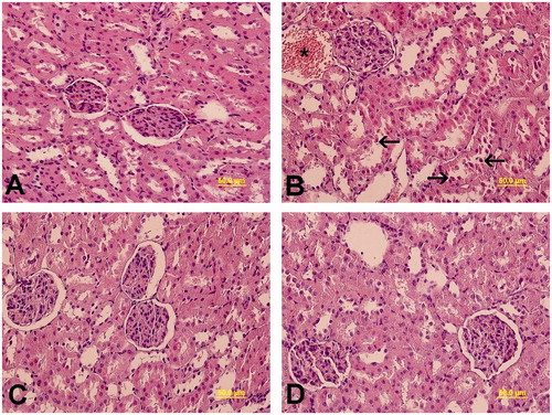 Figure 1. Light microscopy of kidney tissue in different groups was observed. (A) In Group 1, normal kidney architecture was shown. (B) In group 2, epithelial desquamation into the lumen of the tubules (arrow), and dilatation and congestion of the peritubular vessels (*) were visualized. (C) In group 3, normal kidney architecture was observed. (D) In group 4, normal kidney architecture was exhibited. Kidney cross sections were stained with H&E.