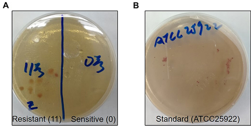 Figure 1 The growth of standard bacteria, susceptible and drug-resistant Escherichia coli in the culture medium.