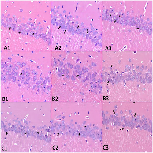 Figure 8 Results of HE staining in hippocampus CA1 region of rats in each group (HE staining x 400) ↑: pyramidal cells. A1:CON1, A2: CON7, A3:CON28, normal pathological appearance. B1:aMCI1, B2: aMCI7, B3: aMCI28, pathological damage was obvious and had a trend of aggravation. C1:HBO1, C2 HBO7, C3: HBO28, pathological damage was reduced.