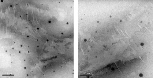 Figure 5 Transmission electron microscopy of the rotigotine-loaded microemulsion.