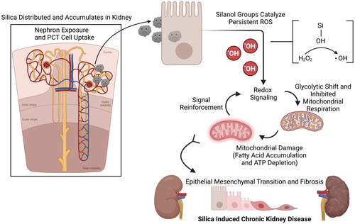 Figure 5. Hypothesized mechanism of SiNP-mediated kidney disease.