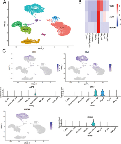 Figure 7 Single cell analysis to identify the expression of ACP5, CCL3 and HMOX1 in atherosclerotic samples. (A) Umap of eight cell types in GSE159677. (B) Three AS diagnostic genes had high expression levels in macrophages. (C) Feature and violin plots showing the distribution of three AS diagnostic genes in various cell types.