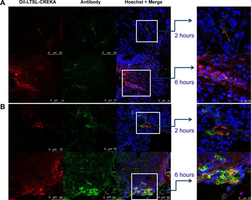 Figure 6 Localization of DiI-LTSL-CREKA in tumor tissue.Notes: BALB/c nude mice bearing MCF-7/ADR tumors (~200 mm3) were intravenously injected with DiI-LTSL-CREKA at a dose of 200 μg/kg. At 2-hour or 6-hour time point, the mice in the experiment were sacrificed, the tumors were harvested, and tumor sections were examined for fluorescence. DiI-LTSL-CREKA (red) accumulates in tumor blood vessels (anti-CD31, green) (A) and co-localizes with anti-fibrin (ogen) (green) staining (B). The results are representative of four independent experiments. Magnification: ×200.Abbreviations: DiI, 1,1′-dioctadecyl-3,3,3′,3′-tetramethylindocarbocyanine perchlorate; LTSL, lysolipid-containing thermosensitive liposome; CREKA, Cys-Arg-Glu-Lys-Ala.