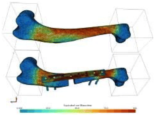 Figure 2 FE simulations of compression tests on intact (up) and repaired (down) canine humerus