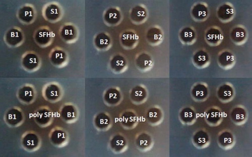 Figure 2. Ouchterlony double diffusion test for determining antigen specific antibody activation. Equal amounts of stroma-free hemolysate (SFHb) (1g/dl) were placed into the central well of the 8% agarose gel plate (containing 2% sodium azide) and the same amount of serum from rat S1 (stroma-free hemolysate - SFHb injected) (positive control), rat P1 (purified stroma-free polyhemolysate - SFPolyHb injected) (test) and rat B1 (buffer injected) (negative control) were placed into two diagonal wells in duplicates, respectively (Fig. 1). The serum from rats S2, S3, P2, P3 and B2, B3 were repeated in the same way. We replaced stroma-free hemolysate - SFHb with stroma-free polyhemolysate into the central well and repeated the same procedure as above to determine anti-stroma-free polyhemolysate specific antibody production. All plates were incubated at room temperature in a humid environment for four days.