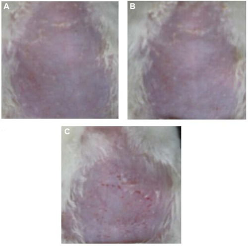 Figure 8 Skin irritancy studies on rat abdomens.Notes: (A) No drug. (B) Rotigotine microemulsion gel administration. (C) Neupro® patch administration.