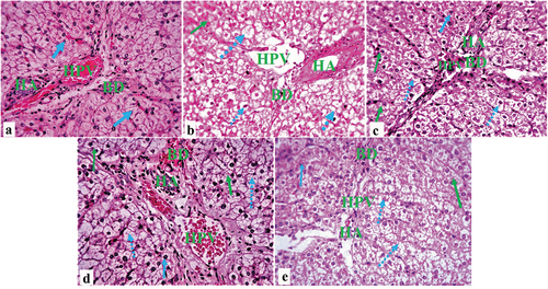 Figure 4. Composite photomicrographs of non-atherosclerotic and atherosclerotic pig liver showing normal cytoarchitecture of the hepatocyte (blue arrow), hepatic artery (HA), hepatic portal vein (HPV) and bile duct (BD) (a); hepatocellular vacuoles (steatosis) of varying sizes (dotted arrow), ballooning degeneration, and necrosis (green arrow) (b); and a dose-dependent hepatocyte restoration (c, d, & e). H&E X 250. A = liver of normal control pigs, B = liver of atherosclerotic control pigs, C = liver of pigs treated with 250 mL/day Camel milk, D = liver of pigs treated with 500 mL/day Camel milk, E = liver of pigs treated with Metformin.