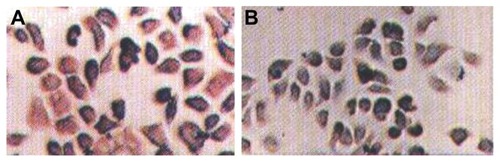 Figure 1 Immunohistochemistry of (A) Bcl-2 and (B) Bax cholangiocarcinoma FRH-0201 cells.