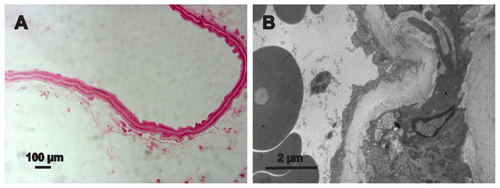 Figure S4 Prussian blue staining, TEM examination of the control groups.Notes: (A) Prussian blue staining showed no blue-stained iron particles in the lesion area of the control animals. (B) TEM further demonstrated no iron particles accumulated in the lesion area of the control animals. Scale bar A measures 100 μm, B measures 2 μm.Abbreviation: TEM, transmission electron microscope.