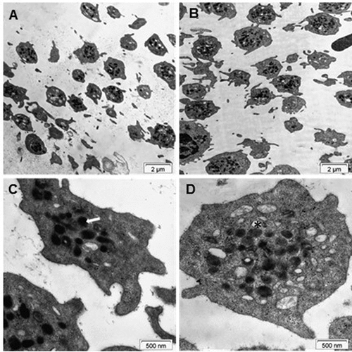 Figure 4. Electron microscopy of platelets. TEM images of platelets of healthy subjects from the lower (A and C) and upper (B and D) fractions. The arrow in C and the asterisk in D point at an alpha-granule and a dense granule, respectively.